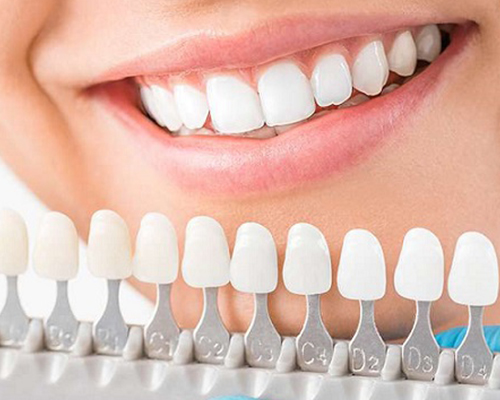 Cosmetic Dentistry